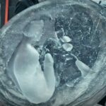 The outline of a person is surrounded by hard matter in a "fossil" from the machine in The Leftovers finale