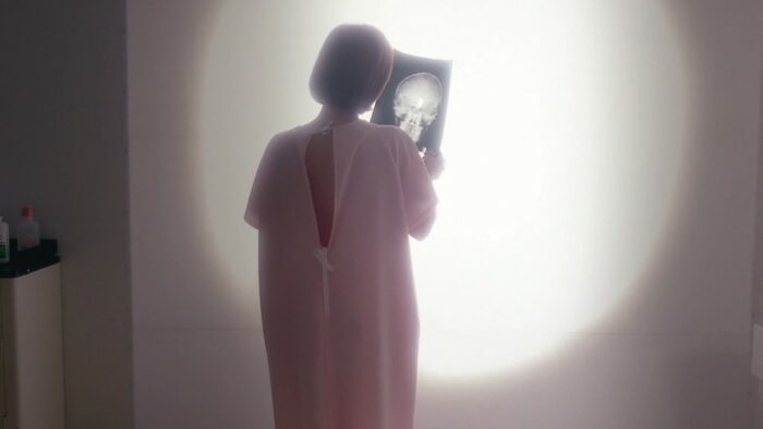 Agent Scully, wearing a hospital gown, looks at a scan of her brain, which reveals a brain tumour 