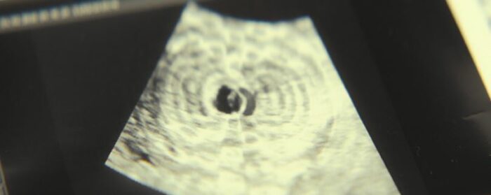 An ultrasound showing an interference pattern, in Constellation S1E8